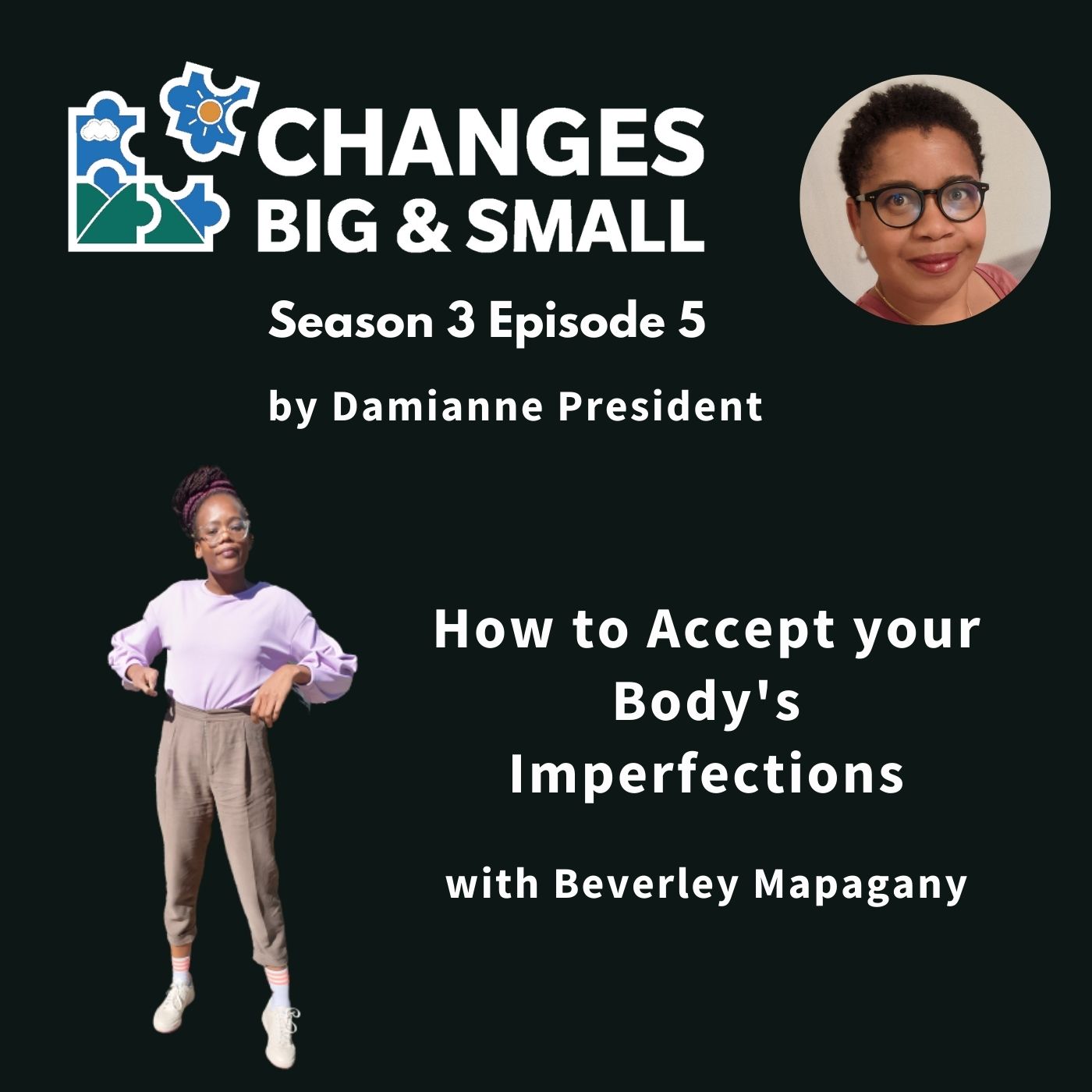 How to Accept Your Body’s Imperfections